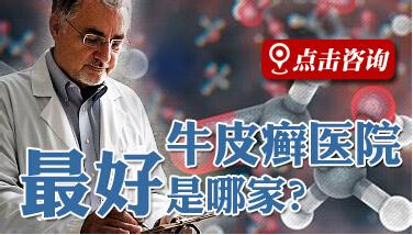 如何治疗顽固性的寻常型牛皮癣比较好