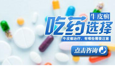 治疗牛皮癣好的药物是什么